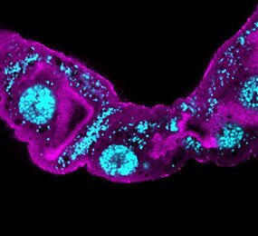 Descoberta diversidade em bactérias antivirais