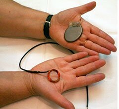 Português desenvolve sistema para recarregar baterias de dispositivos médicos implantáveis