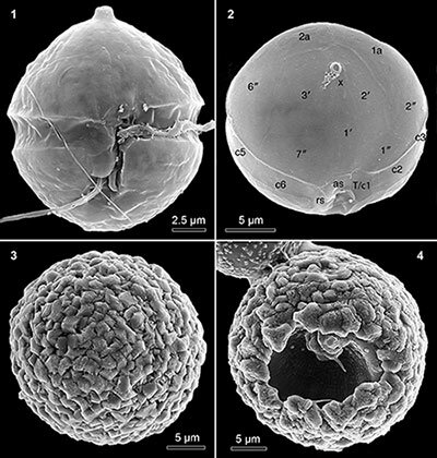 Biólogos da Universidade de Aveiro descobrem nova espécie de microalga